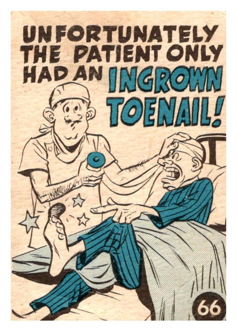 1961 Topps Crazy Card Comics #66 A Doctor Once Performed A... V51132