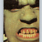 1979 Marvel Incredibale Hulk #81 The Force Inside Banner  V35101