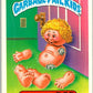 1985 Topps Garbage Pail Kids Series 1 #6b Busted Bob   V44319