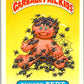 1985 Topps Garbage Pail Kids Series 1 #11b Bugged Bert   V44367